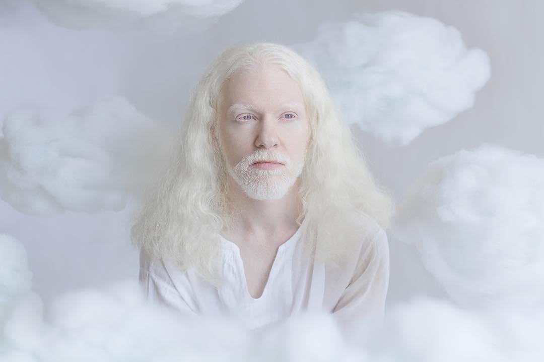 breathtaking-beauty-of-albinos-was-captured-by-a-photographer-04