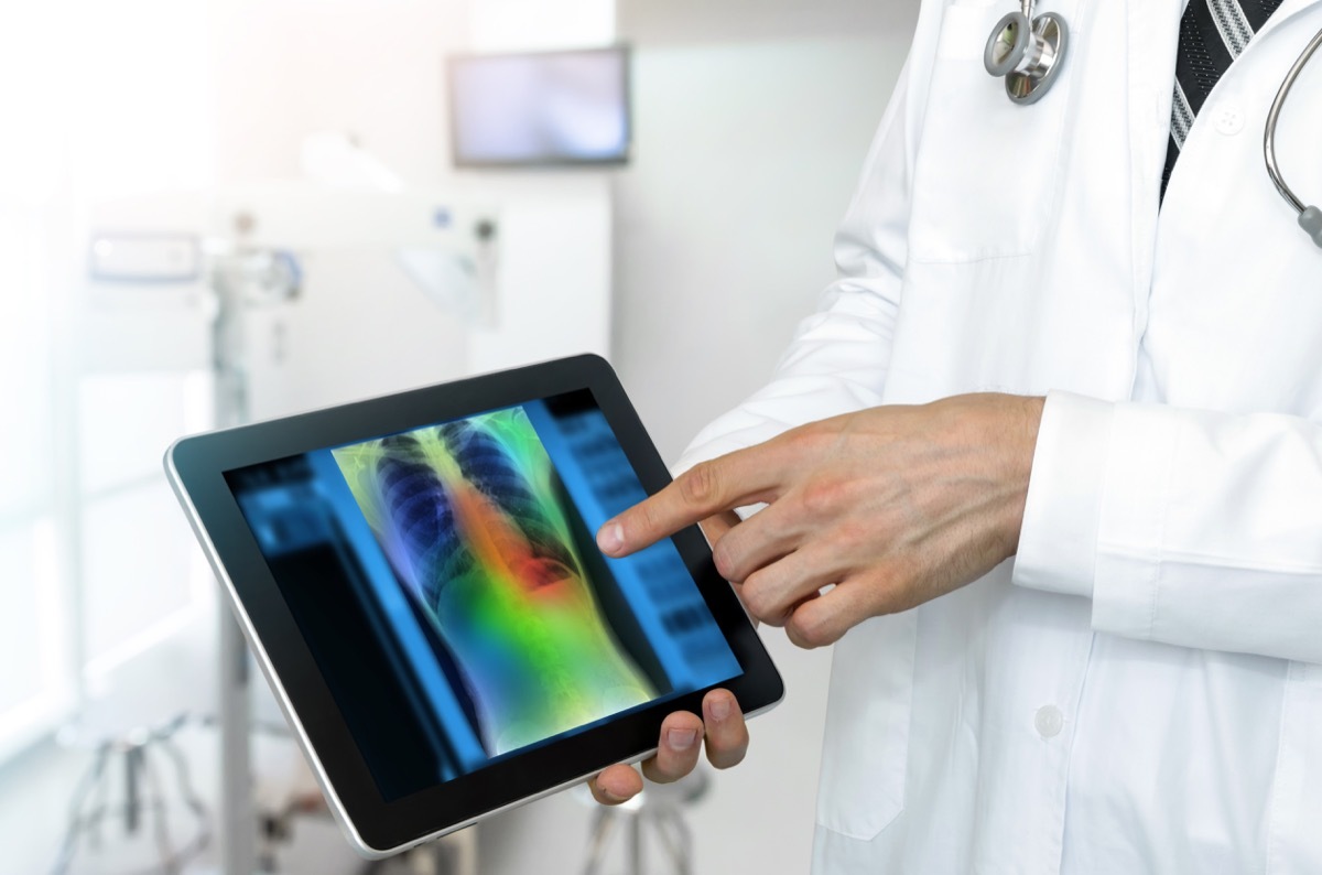 doctor shows patient chest x-ray on tablet