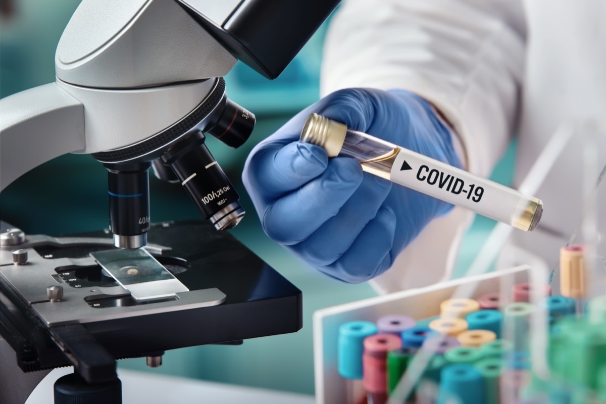 microbiologist with a tube of biological sample contaminated by Coronavirus with label Covid-19 