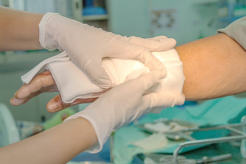 person getting gauze bandaged for burn