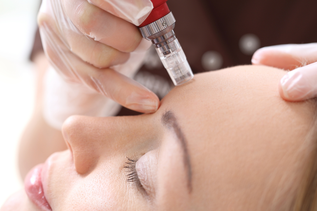 Microneedling Anti-Aging